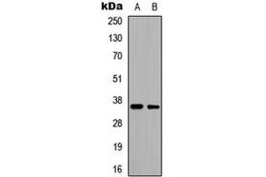 Western blot analysis of CD34 expression in HeLa (A), HepG2 (B) whole cell lysates.