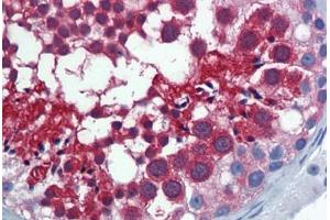 Human Testis: Formalin-Fixed, Paraffin-Embedded (FFPE) (Importin 5 Antikörper  (AA 1-101))