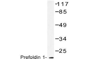 Western blot (WB) analysis of Prefoldin 1 antibody in extracts from RAW264. (PFDN1 Antikörper)
