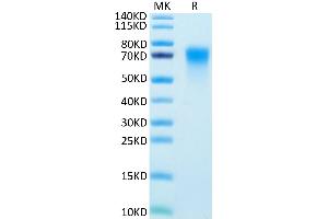 Human DR6 on Tris-Bis PAGE under reduced condition. (TNFRSF21 Protein (AA 42-349) (His tag))