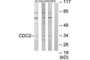 Western Blotting (WB) image for anti-Cyclin-Dependent Kinase 1 (CDK1) (AA 101-150) antibody (ABIN2889380) (CDK1 Antikörper  (AA 101-150))