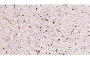 Detection of NGAL in Rat Cerebrum Tissue using Monoclonal Antibody to Neutrophil gelatinase-associated lipocalin (NGAL) (Lipocalin 2 Antikörper  (AA 21-198))