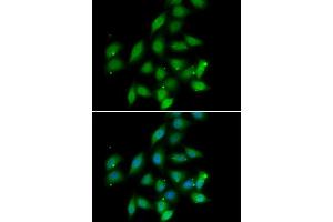 Immunofluorescence analysis of HeLa cell using PPP2CA antibody. (PPP2CA Antikörper)