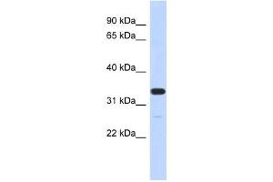 FAM76A antibody used at 1 ug/ml to detect target protein. (FAM76A Antikörper  (N-Term))