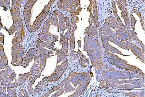 IHC analysis of RALBP1 using anti-RALBP1 antibody (ABIN7600800). (RALBP1 Antikörper  (AA 239-506))