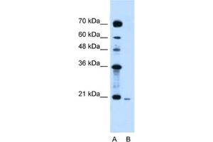 Western Blotting (WB) image for anti-Synovial Sarcoma, X Breakpoint 2 (SSX2) antibody (ABIN2461583) (SSX2 Antikörper)