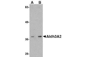 Western blot analysis of Aldh3A2 in mouse liver lysate with AP30044PU-N Aldh3A2 antibody at (A) 1 and (B) 2 μg/ml. (ALDH3A2 Antikörper  (C-Term))