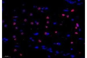 Immunofluorescent analysis of paraformaldehyde-fixed rat hippocampus using ZNF154 (ABIN7076261) at dilution of 1: 1000 (ZNF154 Antikörper)
