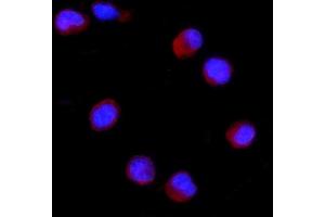 IF analysis of CD27 using anti-CD27 antibody (ABIN4886519). (CD27 Antikörper  (AA 20-191))