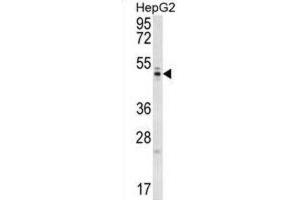 Western Blotting (WB) image for anti-WD Repeat Domain 12 (WDR12) antibody (ABIN5016731) (WDR12 Antikörper)
