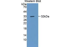 Western Blotting (WB) image for anti-C-Ros Oncogene 1 , Receptor tyrosine Kinase (ROS1) (AA 1937-2210) antibody (ABIN1870413)