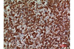 Immunohistochemistry (IHC) analysis of paraffin-embedded Human Liver, antibody was diluted at 1:100. (CCR3 Antikörper  (N-Term))