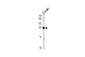 DANRE neurog1 Antibody (Center) Azb10027b western blot analysis in zebra fish brain tissue lysates (35 μg/lane). (Neurogenin 1 Antikörper  (AA 112-138))