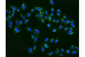 IF analysis of MEK2/MAP2K2 using anti-MEK2/MAP2K2 antibody (ABIN7599357). (MEK2 Antikörper  (AA 1-400))
