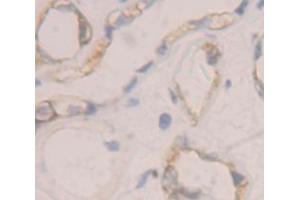 IHC-P analysis of Human Tissue, with DAB staining. (IL12RB1 Antikörper  (AA 37-234))