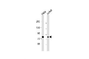 Western Blot at 1:1000 dilution Lane 1: Hela whole cell lysate Lane 2: Jurkat whole cell lysate Lysates/proteins at 20 ug per lane. (HADHA Antikörper  (C-Term))