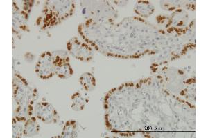 Immunoperoxidase of monoclonal antibody to TFAP2A on formalin-fixed paraffin-embedded human placenta. (TFAP2A Antikörper  (AA 99-205))