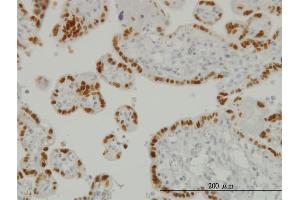 Immunoperoxidase of monoclonal antibody to TFAP2A on formalin-fixed paraffin-embedded human placenta.