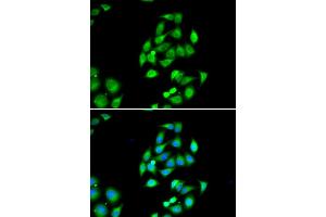 Immunofluorescence analysis of HeLa cells using NFS1 antibody (ABIN6291967). (NFS1 Antikörper)