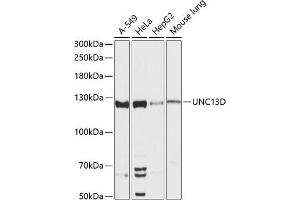 Western blot analysis of extracts of various cell lines, using UNC13D antibody (ABIN6130567, ABIN6149931, ABIN6149932 and ABIN6217024) at 1:3000 dilution. (UNC13D Antikörper  (AA 891-1090))