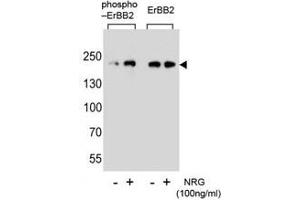 Western blot analysis of extracts from SK-BR-3 cell, untreated or treated with NRG, using phospho-ErbB2 (left) or nonphos Ab (right). (ErbB2/Her2 Antikörper  (pTyr1140))