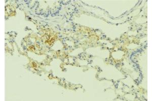 ABIN6275172 at 1/100 staining Human lung tissue by IHC-P.