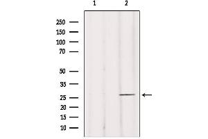 Western blot analysis of extracts from mouse brain, using BRMS1 Antibody. (BRMS1 Antikörper  (N-Term))