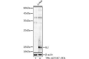 Western blot analysis of extracts of Jurkat cells, using IL2 antibody (ABIN3020908, ABIN3020909, ABIN3020910 and ABIN6213790) at 1:1000 dilution. (IL-2 Antikörper  (AA 21-153))