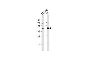 Western Blotting (WB) image for anti-NK2 Homeobox 1 (NKX2-1) (AA 1-30), (N-Term) antibody (ABIN654691)