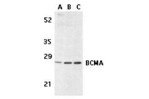 Western blot analysis of BCMA in human spleen (A) tissue lysate, K562 (B), and U937 (C) cell lysates with AP30133PU-N BCMA antibody at 5 μg/ml. (BCMA Antikörper)