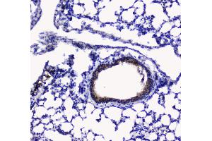 Immunohistochemistry (IHC) image for anti-Betacellulin (BTC) (AA 32-177) antibody (ABIN5692803)