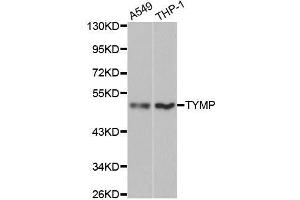 Western blot analysis of extracts of various cell lines, using TYMP antibody. (Thymidine Phosphorylase Antikörper  (AA 1-200))