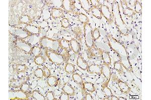 Formalin-fixed and paraffin embedded mouse kidney labeled with Rabbit Anti-APG5L/ATG5 Polyclonal Antibody (ABIN752413) at 1:100 followed by conjugation to the secondary antibody and DAB staining. (ATG5 Antikörper  (AA 101-200))