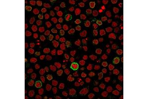 Immunofluorescence (IF) image for anti-CD5 (CD5) (AA 269-366) antibody (ABIN6941057)