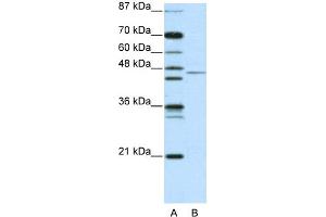 WB Suggested Anti-TRIM14 Antibody   Titration: 2. (TRIM14 Antikörper  (N-Term))