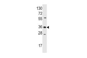 Western blot analysis of anti-AKR1B1 Pab (ABIN389206 and ABIN2839364) in Jurkat cell line lysates (35 μg/lane). (AKR1B1 Antikörper  (AA 102-135))