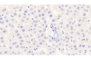 Detection of SIRT4 in Rat Liver Tissue using Polyclonal Antibody to Sirtuin 4 (SIRT4) (SIRT4 Antikörper  (AA 60-255))