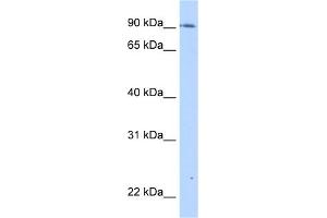 WB Suggested Anti-TMEM24 Antibody Titration:  0. (C2CD2L Antikörper  (C-Term))