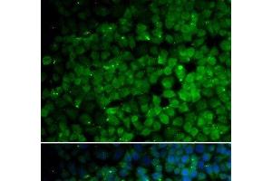 Immunofluorescence analysis of HeLa cells using TRIM13 Polyclonal Antibody (TRIM13 Antikörper)