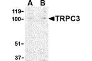 Western blot analysis of TRPC3 in mouse heart tissue lysate with this product at (A) 1 and (B) 2 μg/ml. (TRPC3 Antikörper  (N-Term))