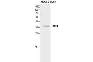 Western Blotting (WB) image for anti-ADP-Ribosyltransferase 1 (ART1) antibody (ABIN5958873)