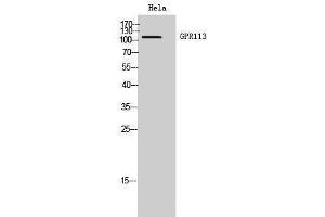 Western Blotting (WB) image for anti-G Protein-Coupled Receptor 113 (GPR113) (N-Term) antibody (ABIN3184836) (GPR113 Antikörper  (N-Term))