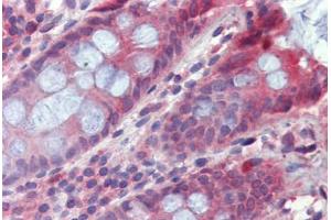 Colon, Human: Formalin-Fixed, Paraffin-Embedded (FFPE) (TPCN2 Antikörper  (AA 735-747))