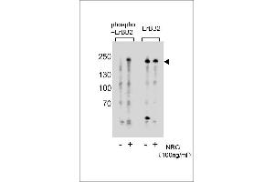 Western blot analysis of extracts from T47D cells, untreated or treated with NRG, 100 ng/mL, using phospho-ErBB2 (left) or ErBB2 Antibody (right). (ErbB2/Her2 Antikörper  (pTyr877))