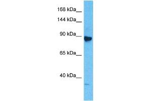 Host:  Rabbit  Target Name:  MCM6  Sample Type:  Jurkat Whole Cell lysates  Antibody Dilution:  1.