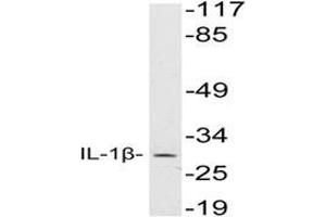 Western blot analysis of IL-1B Antibody in extracts from HeLa cells. (IL-1 beta Antikörper)