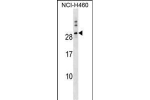 TTYH1 Antibody (N-term) (ABIN1538857 and ABIN2849795) western blot analysis in NCI- cell line lysates (35 μg/lane). (TTYH1 Antikörper  (N-Term))