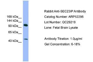WB Suggested Anti-SEC23IP  Antibody Titration: 0. (SEC23IP Antikörper  (N-Term))