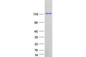 Western Blotting (WB) image for UPF1 Regulator of Nonsense Transcripts Homolog (UPF1) protein (Myc-DYKDDDDK Tag) (ABIN2735034)