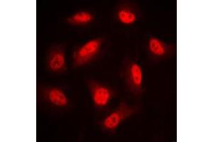 Immunofluorescent analysis of LIMK1/2 (pT508/505) staining in PC12 cells. (LIMK-1/2 (C-Term), (pSer505), (pSer508) Antikörper)